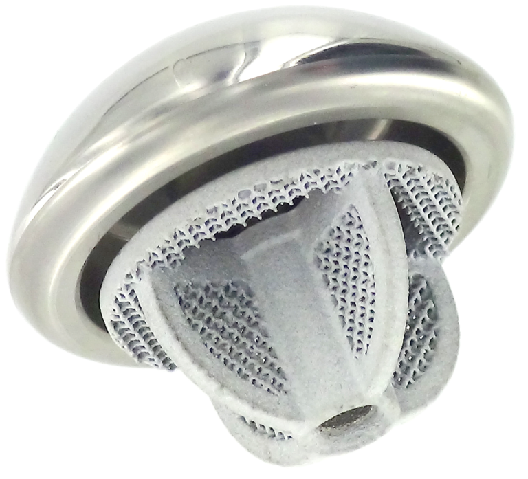 unic stemless et tête humérale 3