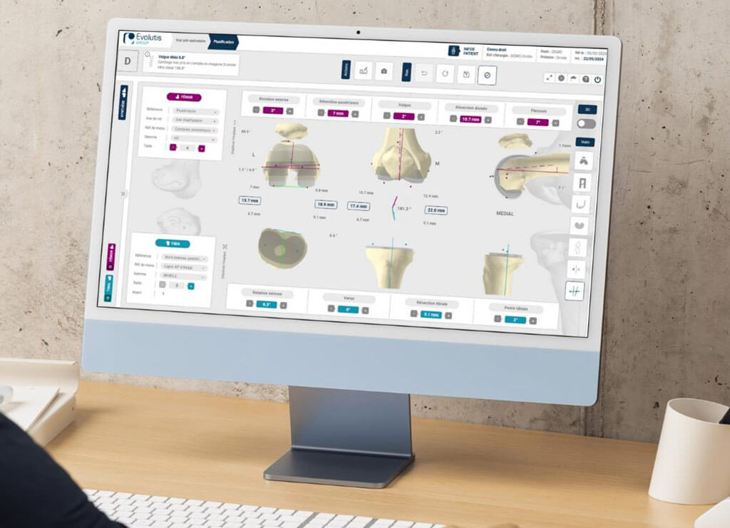 screen genou 3d 2