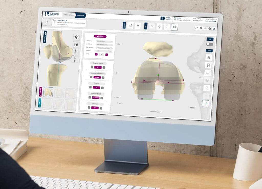 screen genou 3d 3