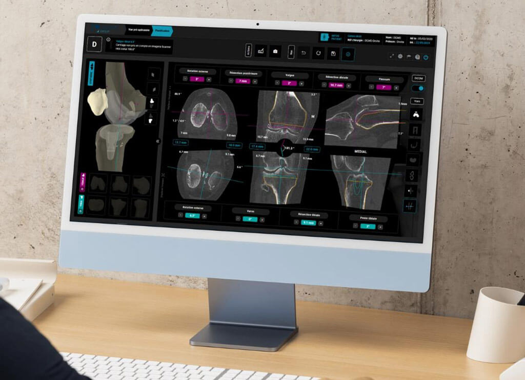 screen genou 3d 4